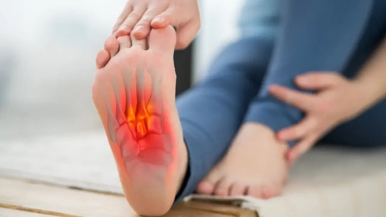 Pie con dolor e inflamación en la planta, indicando fascitis plantar.