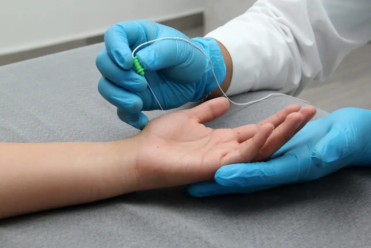 Un profesional con guantes azules realiza una electromiograf&iacute;a que es un estudio de la actividad el&eacute;ctrica de los m&uacute;sculos.