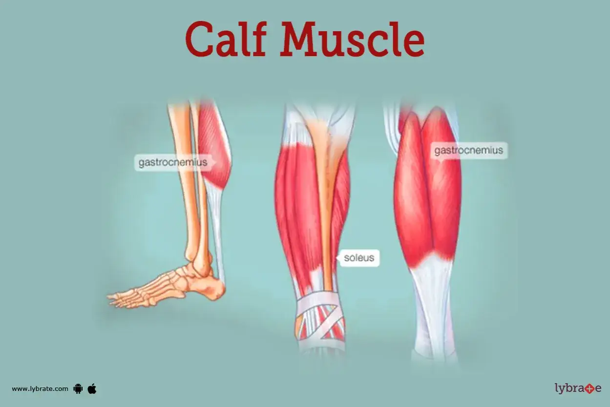 Ilustración anatómica del gemelo, mostrando las fibras musculares del gastrocnemio y el sóleo.