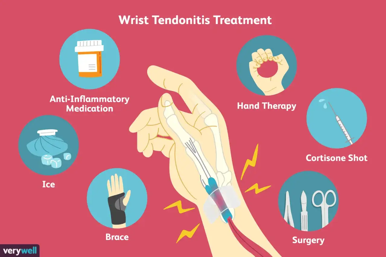 Tratamiento para tendinitis de muñeca: medicación, hielo, férula, terapia manual, inyección de cortisona y cirugía. Los ejercicios son clave.