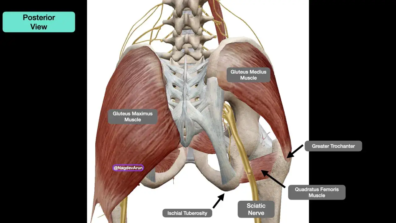 Vista posterior de la pelvis y glúteos, mostrando el nervio ciático y músculos. Podría indicar dolor glúteo izquierdo.