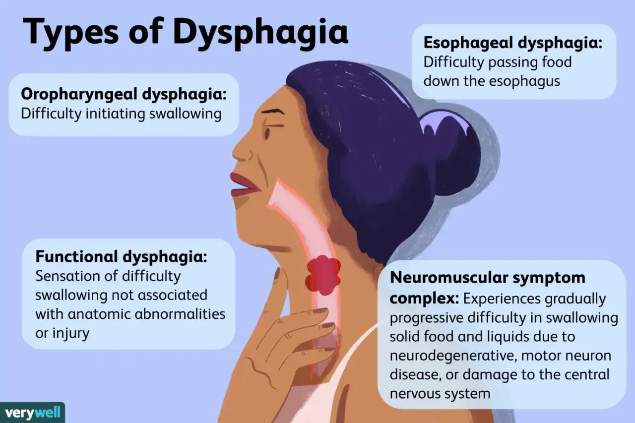 Ilustraci&oacute;n explica qu&eacute; es la disfagia, detallando tipos como orofar&iacute;ngea, esof&aacute;gica, funcional y neuromuscular.