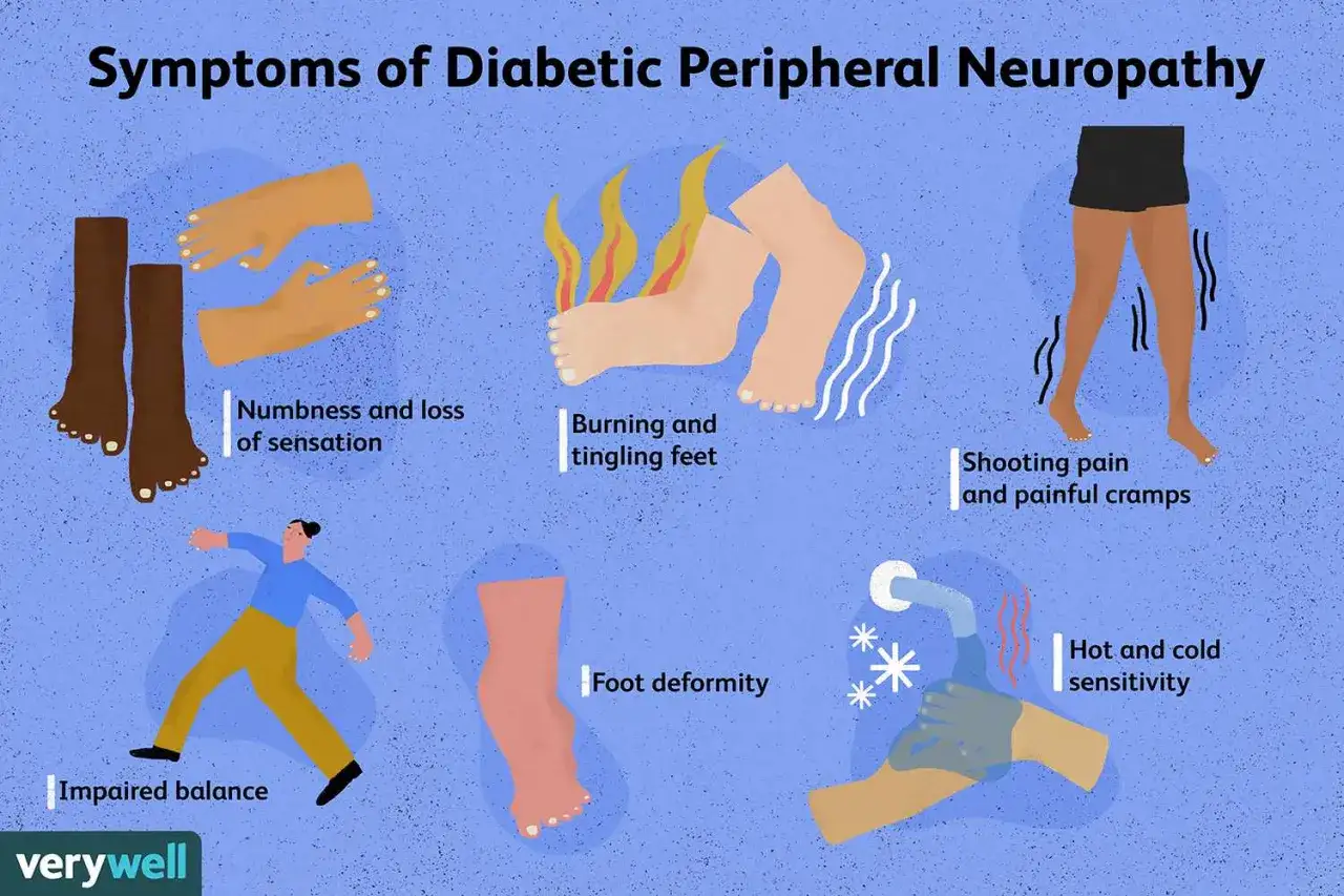 Ilustraci&oacute;n de s&iacute;ntomas de neuropat&iacute;a diab&eacute;tica: entumecimiento, ardor, calambres, desequilibrio, deformidad y sensibilidad a temperatura.