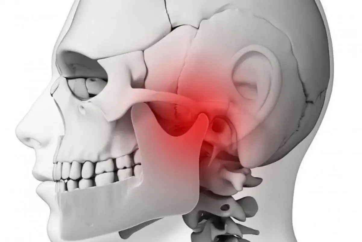 Ilustraci&oacute;n 3D de la articulaci&oacute;n temporomandibular con &aacute;rea en rojo indicando dolor o inflamaci&oacute;n.