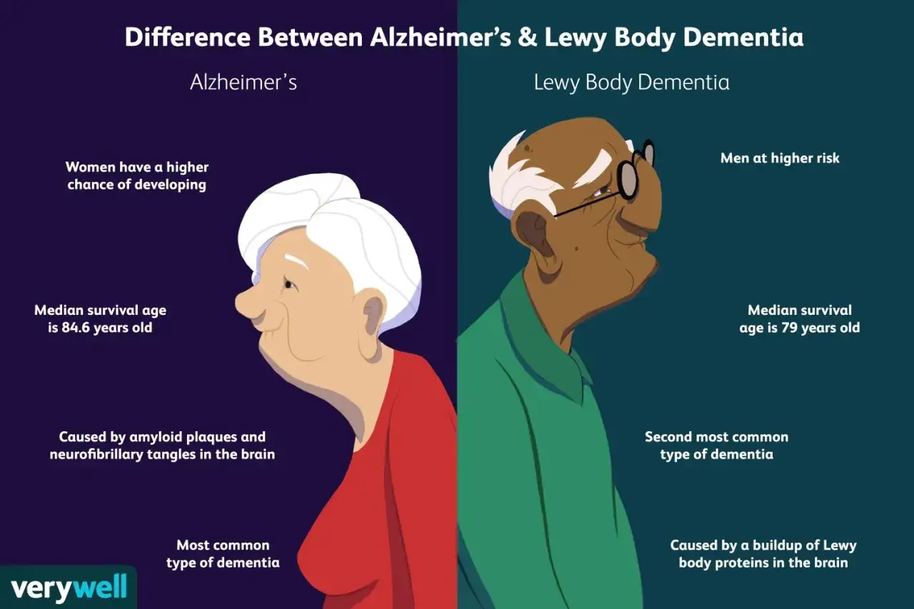 Ilustraci&oacute;n compara Alzheimer y demencia con cuerpos de Lewy. Hombre con demencia por cuerpos de Lewy, con menor esperanza de vida.