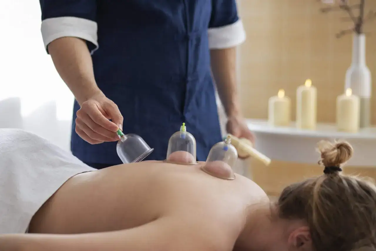 Terapeuta aplica ventosas en la espalda de un paciente para un masaje relajante.