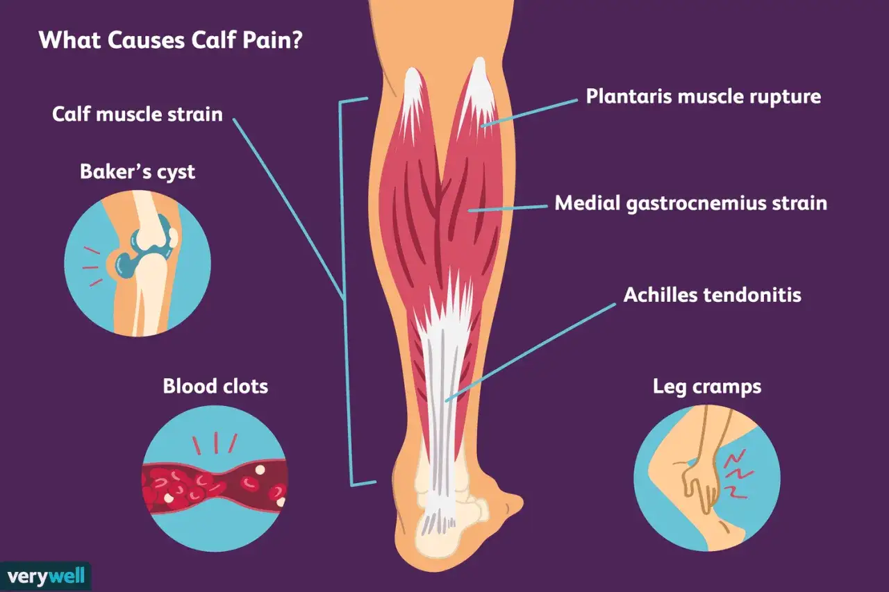 Ilustración de la pierna mostrando causas de dolor, incluyendo contractura gemelo, quiste de Baker, coágulos, desgarro del plantar, tendinitis de Aquiles y calambres.