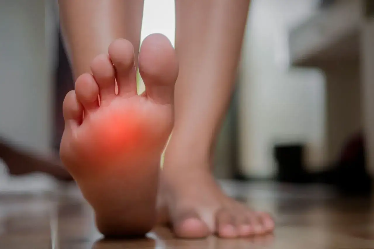 Pie con zona roja de dolor, indicando posible neuroma de Morton.