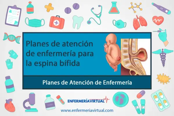 Ilustración de un bebé con espina bífida y su columna vertebral. El texto indica "Planes de atención de enfermería para la espina bífida".